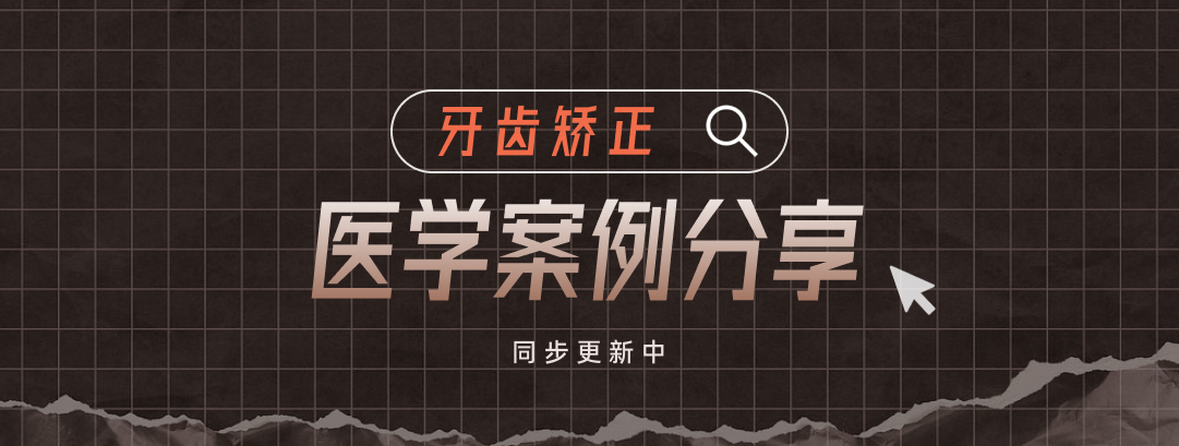 牙齿矫正科普合集|二次矫正案例