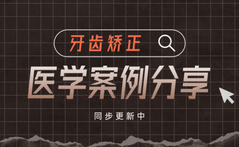 牙齿矫正科普合集｜牙扭转深覆合案例｜上海