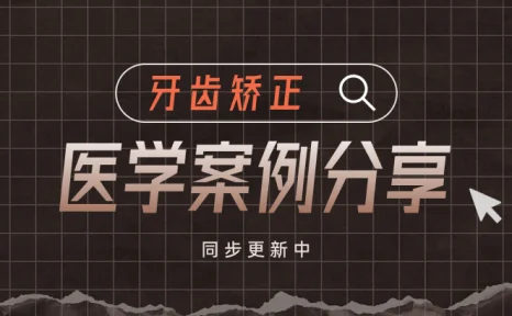 牙齿矫正科普合集|牙扭转深覆合案例