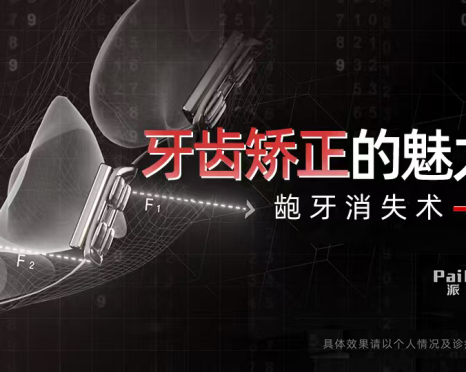 牙齿矫正科普合集|二次矫正案例