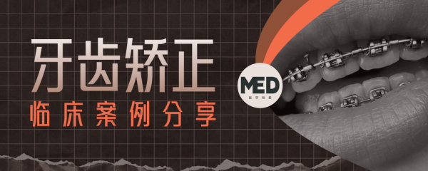 牙齿矫正临床案例