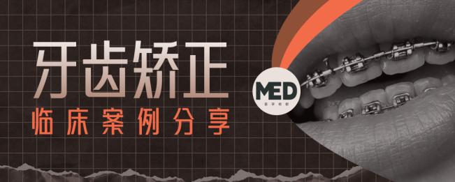 牙齿矫正临床案例